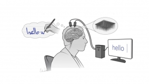 BrainGate felçlilerin hayatını kolaylaştırıyor