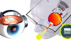 İlk biyonik göz implantı