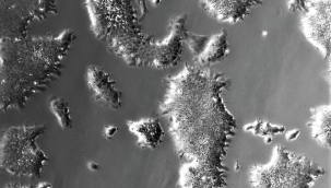 Yapay kök hücresi üretildi