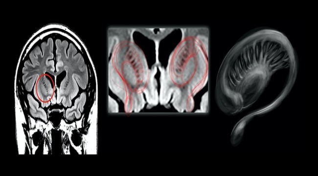 UFO ile karşılaşan pilotların beyinleri incelendi