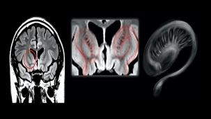 UFO ile karşılaşan pilotların beyinleri incelendi