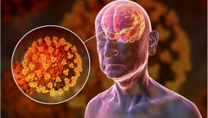 Covid-19, beyin hasarına neden olabiliyor