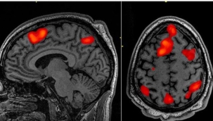 Ölüm anındaki beyin aktivitesi ilk kez kaydedildi