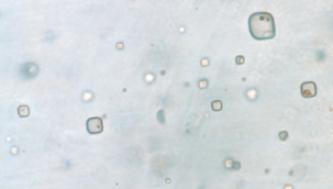 Avustralya'da 830 milyon yıllık organizma bulundu