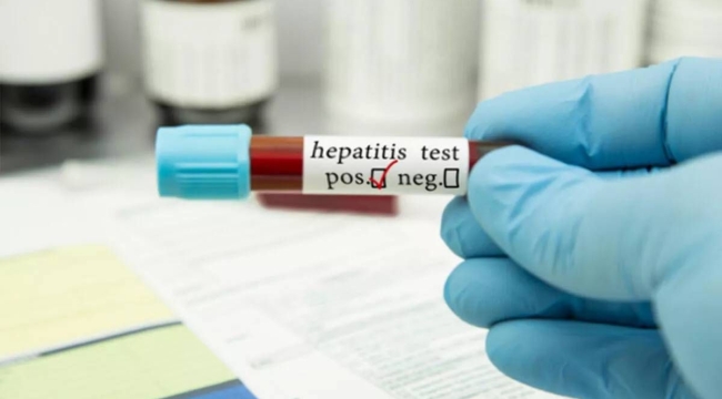 Endonezya'da hepatit virüsünden 3 çocuk öldü