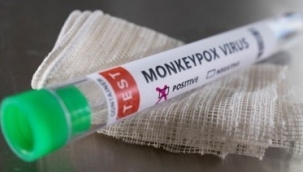 İrlanda'da ilk maymun çiçeği vakası görüldü