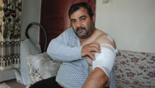 Bartın'da bir işçiye ayı saldırdı