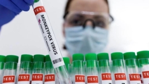 Bulgaristan'da ilk maymun çiçeği vakası