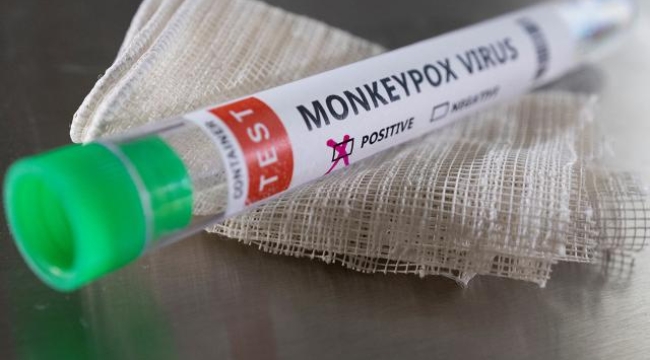 Gürcistan'da ilk maymun çiçeği vakası