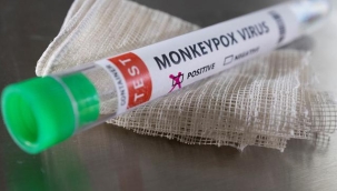 Gürcistan'da ilk maymun çiçeği vakası