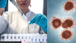 İstanbul'da 3 kişide "maymun çiçeği" şüphesi