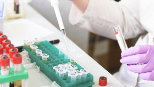 Meksika'da maymun çiçeği hastası ABD'ye kaçtı