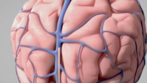 ABD'li Synchron, insan beynine çip yerleştirdi