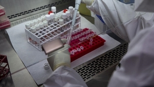 Belçika'da maymun çiçeği vaka sayısı 300'ü geçti