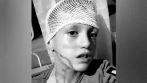 Konya'da bir Suriyeli, bir çocuğun yüzüne kezzap attı