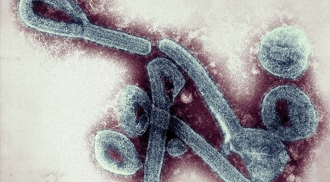 Marburg virüsü: Gana'da 2 kişi öldü