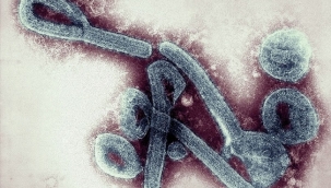 Marburg virüsü: Gana'da 2 kişi öldü