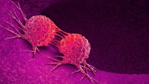 Karaciğer kanserinin yeni bir türü ortaya çıktı