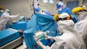 ABD'de maymun çiçeğinden ilk ölüm gerçekleşti