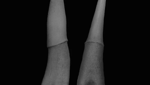 Dişlerin evrimiyle ilgili yeni kanıtlar bulundu