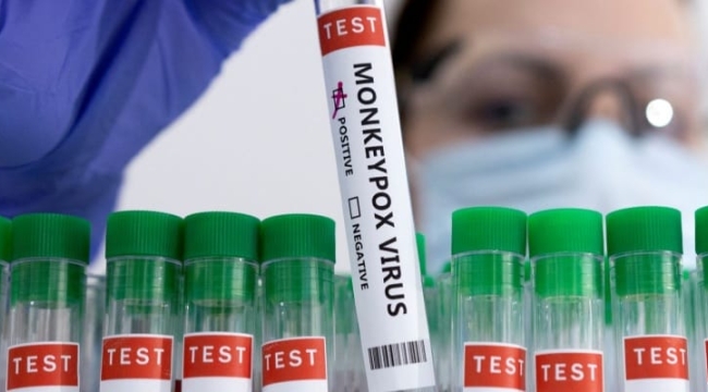 İspanya'da maymun çiçeği vakaları 5 bini aştı