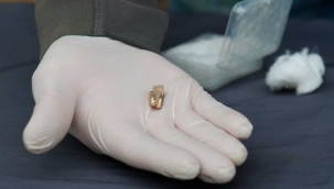 Gürcistan'da 1,8 milyon yıllık diş bulundu