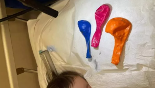 Gaziantep'te bir bebeğin midesinden 3 balon çıktı