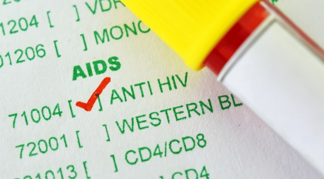 Dr. Akalın: "15-19 yaş HIV+ vakalarda artış var"