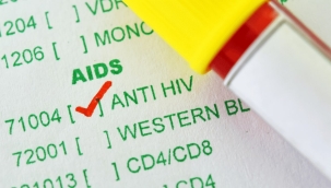 Dr. Akalın: "15-19 yaş HIV+ vakalarda artış var"