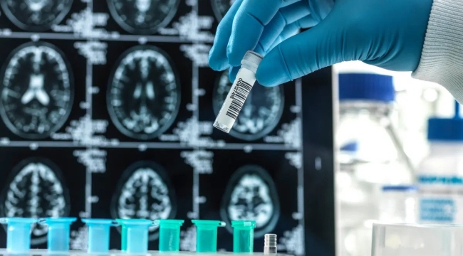 FDA'dan yeni Alzheimer ilacı "lecanemab"a onay