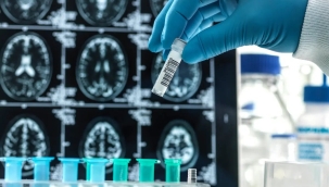 FDA'dan yeni Alzheimer ilacı "lecanemab"a onay