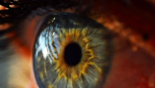 Donör gerektirmeyen "implant kornea" üretildi