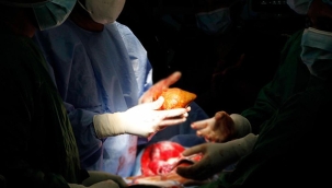 Sri Lanka'da bir hastada 801 gr böbrek taşı çıktı