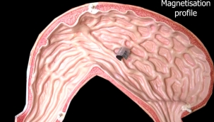 Vücut içinde gezebilecek mini robot geliştirildi