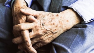 Yaşlı ve zombi hücreleri yok eden ilaç geliştirildi