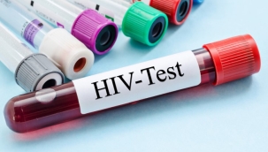 AIDS, Gana'da 2022 yılında 9 bin 354 can aldı