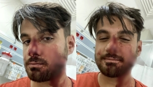 Antep'te bir genç, Suriyeliler tarafından bıçaklandı 