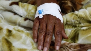 Yemen'de bu yıl 5 binden fazla kolera vakası oldu