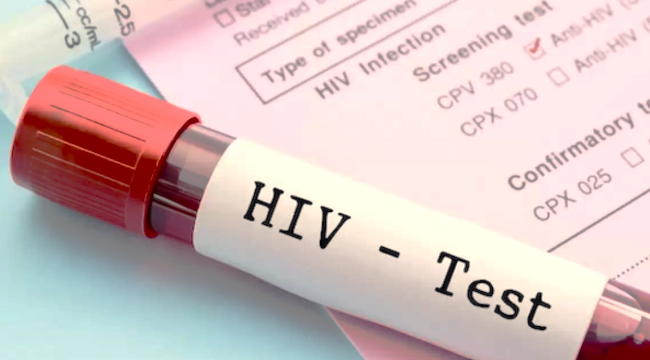 Türkiye'de son 10 yılda HIV hastalığı %400 arttı