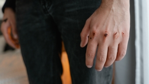 Zaman algısı, yaraların iyileşme hızını etkiliyor