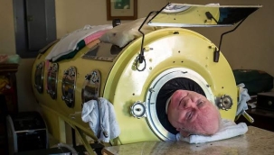 "Demir Akciğerli Adam" hayatını kaybetti