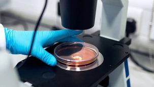 Japonya'da et yiyen bakteri vakası 977'ye çıktı