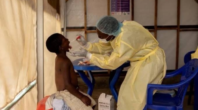 Sudan'da kolera salgınında can kaybı 1072'ye çıktı