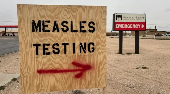 ABD'de kızamık alarmı: 12 eyalette 222 vaka