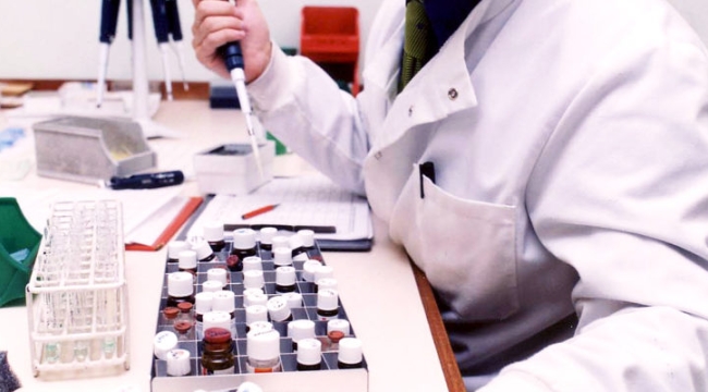 Prostat kanseri tanısı için bir idrar testi geliştirildi
