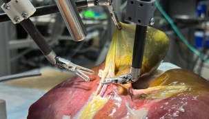 Bir robot, ilk kez tek başına ameliyat yaptı