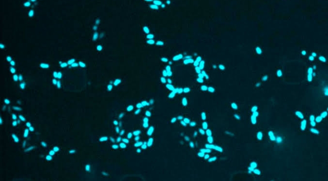 YZ, güçlü etkili yeni antibiyotikler geliştirdi