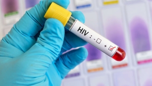 TR'de HIV/AIDS vakaları son 10 yılda 12 kat arttı